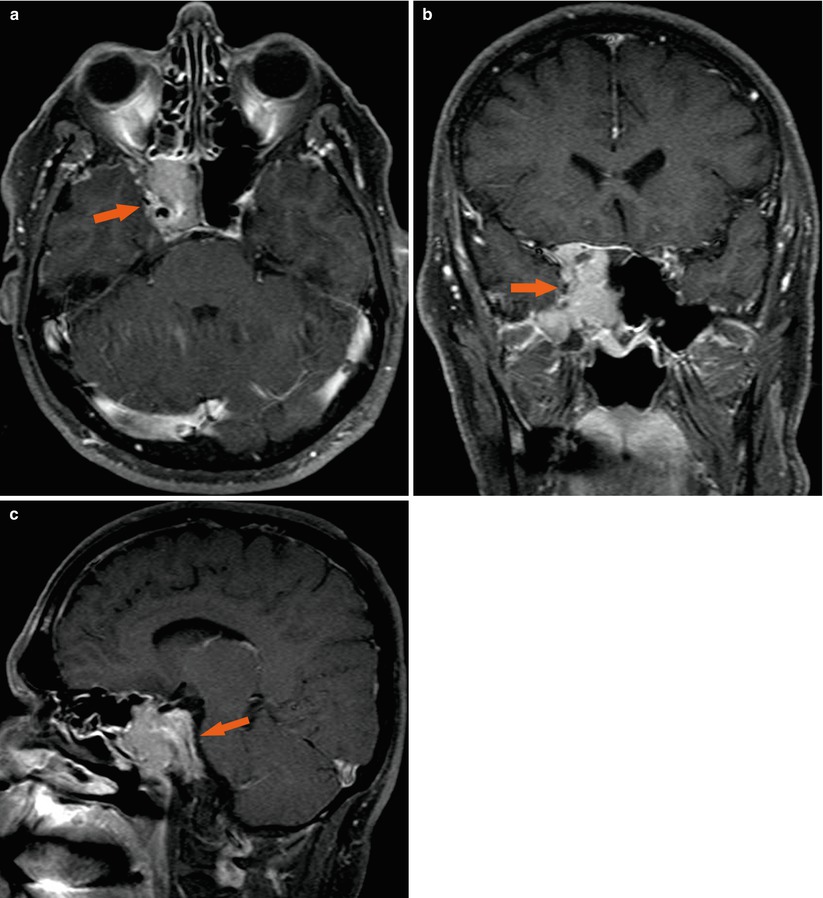 Differential Diagnosis | Radiology Key