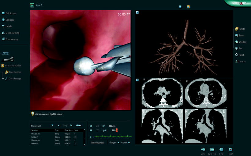 simulation-for-endoscopy-training-radiology-key