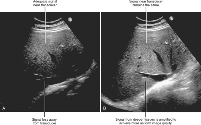 Ultrasound Radiology Key