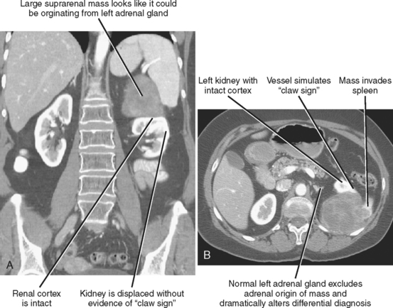 problem solving in abdominal imaging pdf