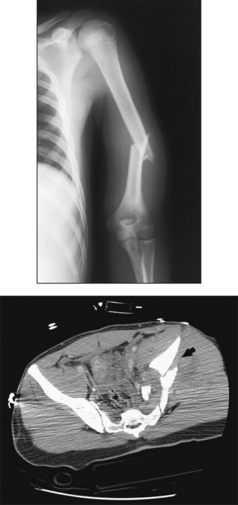 Trauma Radiography Radiology Key