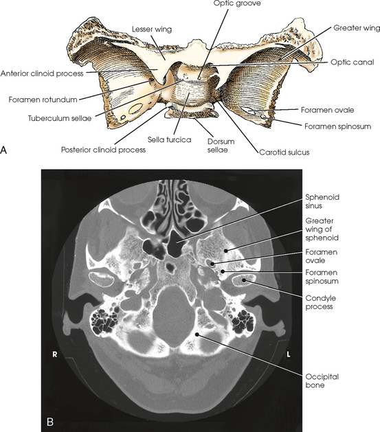 Skull Radiology Key 4695