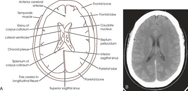 Sectional Anatomy For Radiographers Radiology Key