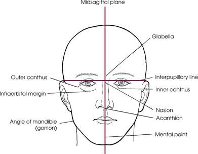 Cranium | Radiology Key