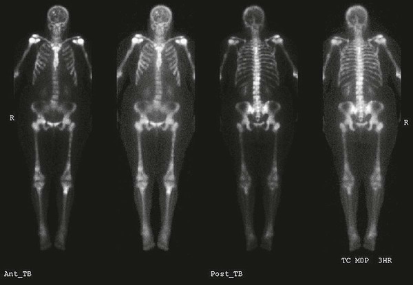 Skeletal System | Radiology Key