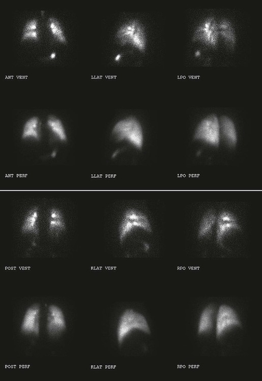 respiratory-system-radiology-key