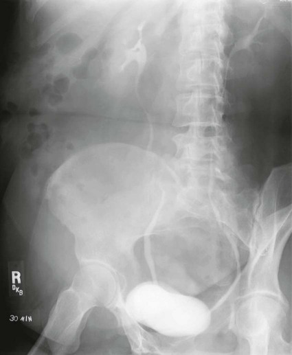 Urinary System Radiology Key