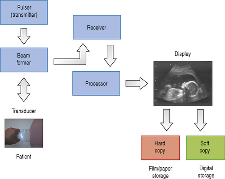Block Diagram Ultrasound Images - How To Guide And Refrence
