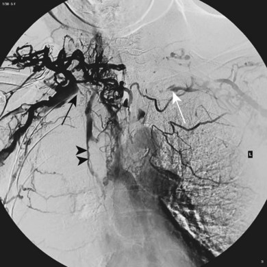 Cardiovascular System | Radiology Key