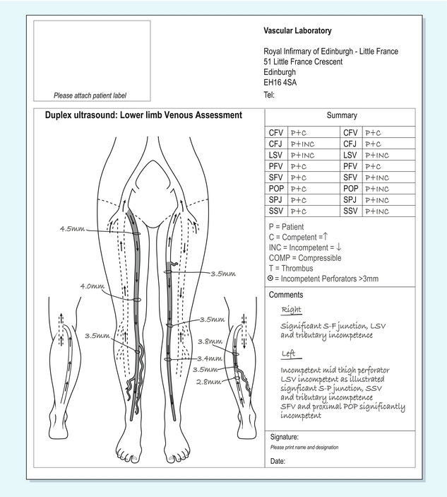 The Peripheral Veins Radiology Key 4794