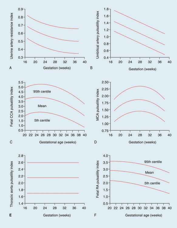 chart umbilical d artery s ratio for Obstetrics Ultrasound in Applications of Doppler Clinical