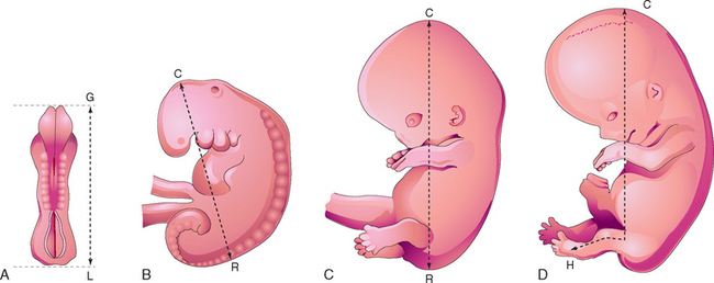 ULTRASOUND EVALUATION DURING THE FIRST TRIMESTER OF PREGNANCY ...