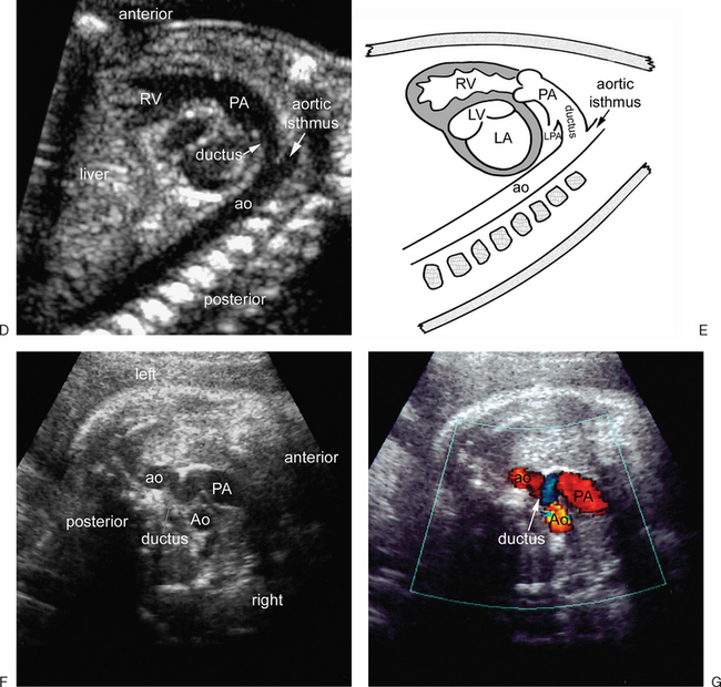 Ultrasound Images Of Fetal Heart - M mode ultrasound measuring a normal ...