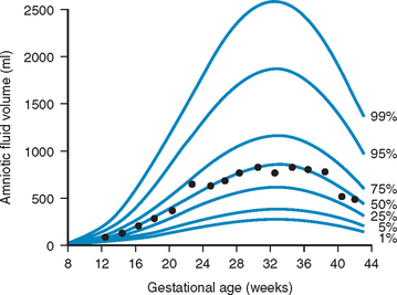 Normal Amniotic Fluid Index Chart In Cm