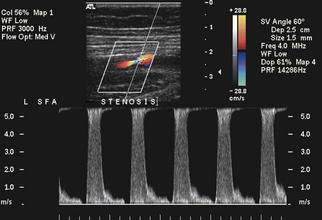 Ultrasound Assessment Of Lower Extremity Arteries Radiology Key Ultrasound Assessment Of Lower Extremity Arteries Radiology Key