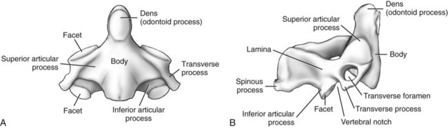 Spine | Radiology Key