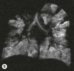 Intravascular Contrast Media for Radiography, CT, MRI and Ultrasound