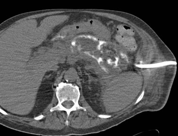 The Pancreas | Radiology Key