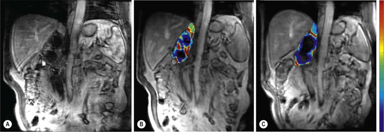 Intravascular Contrast Media for Radiography, CT, MRI and