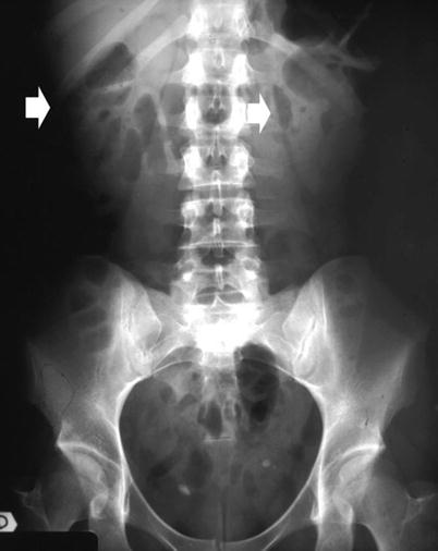 Radiological Anatomy