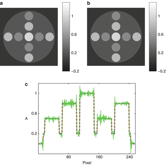 and Thermoacoustic Tomography: Image Formation Principles | Radiology Key