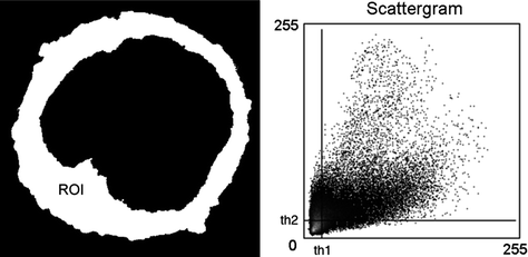 imagej colocalization plugin