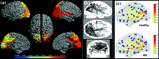 A272390_1_En_12_Fig1_HTML.gif