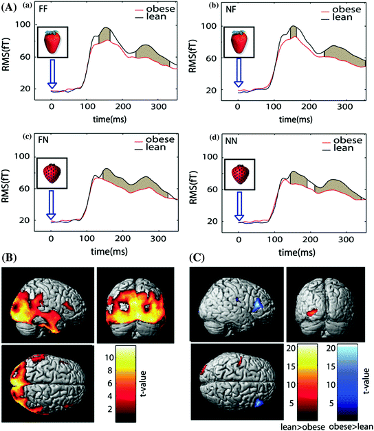 Meets Brain Radiology Key