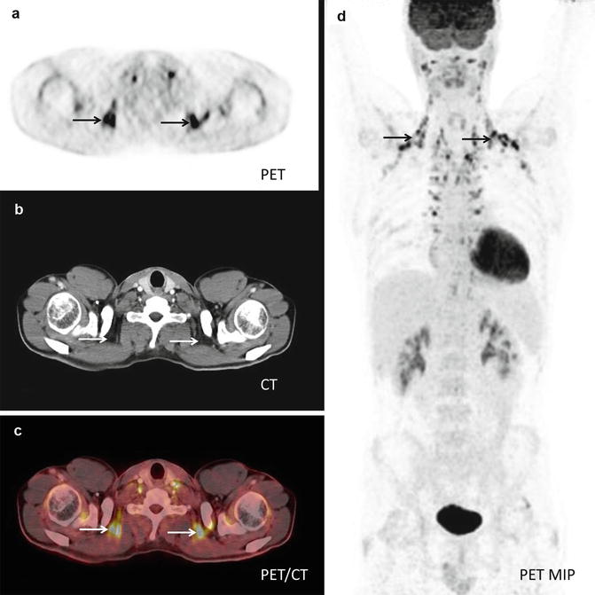 Is A Pet Scan As Claustrophobic As An Mri