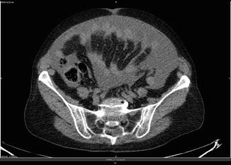 Abdomen | Radiology Key