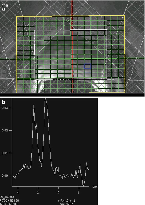 A310128_1_En_10_Fig11_HTML.jpg