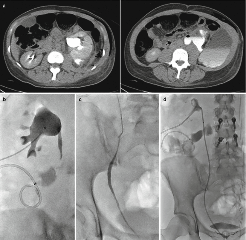 Urinary Diversion and Drainage Radiology Key