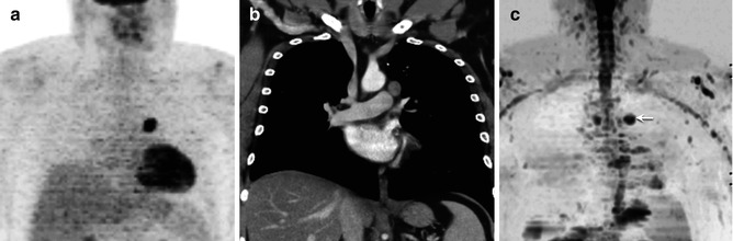 scrotum-radiology-key