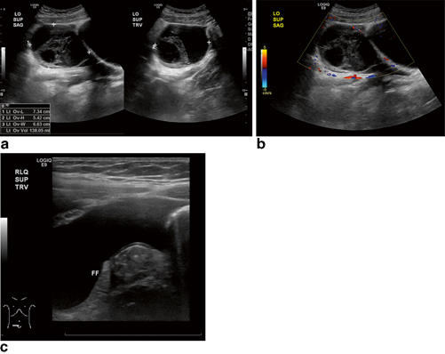 Icd 10 Code For Pelvis Mass 2640