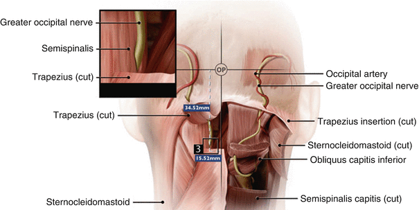 occipital artery