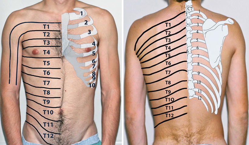 Intercostal Nerve Blocks Radiology Key