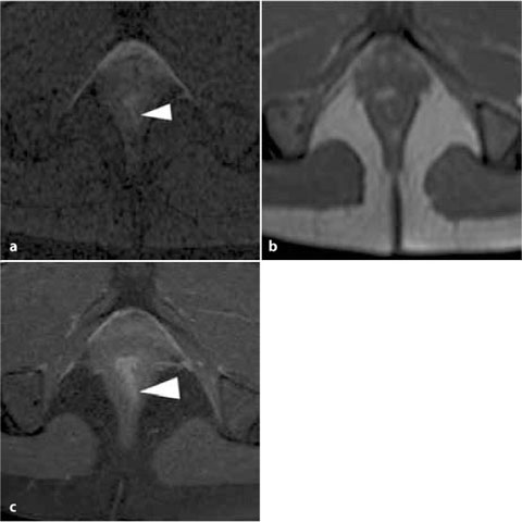 Artifacts and Pitfalls | Radiology Key