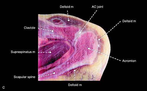 Anatomy of Upper Extremity Joints With Cadaveric Correlation