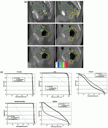 Image-guided Adaptive Radiation Therapy And Practical Perspectives ...