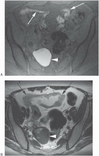 Tissue Contrast: Some Clinical Applications | Radiology Key