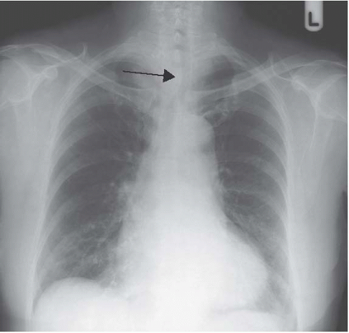 The Systematic Approach | Radiology Key