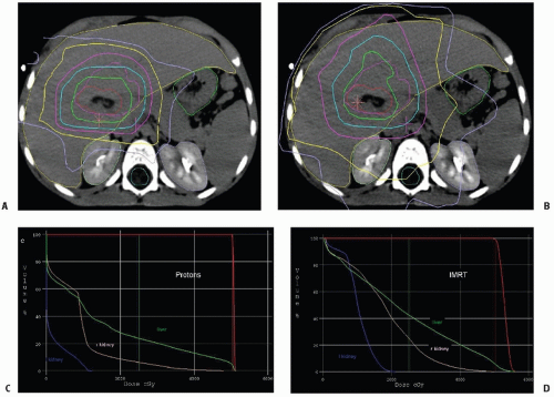 Rhabdomyosarcoma Radiology Key 4893