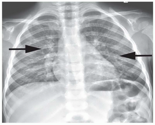 Chest Nontrauma Radiology Key