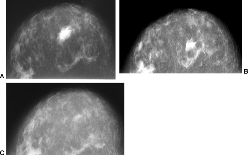 Interpreting The Mammogram Radiology Key 7923