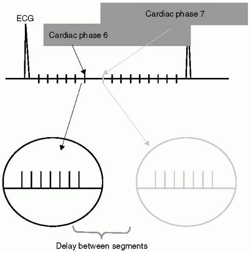 Gradient Echo | Radiology Key