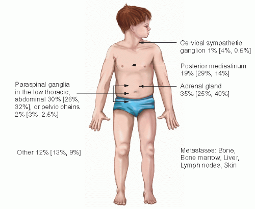 types of neuroblastoma on arm