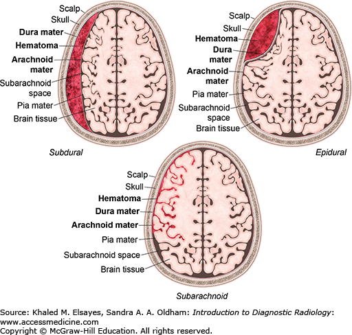Diagnostic Neuroradiology | Radiology Key