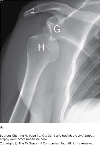 Chapter 7. Imaging of Joints | Radiology Key