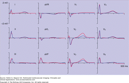 Echocardiography | Radiology Key