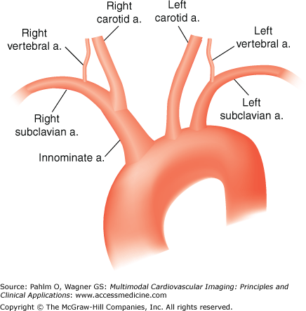 Aorta Artery Anatomy